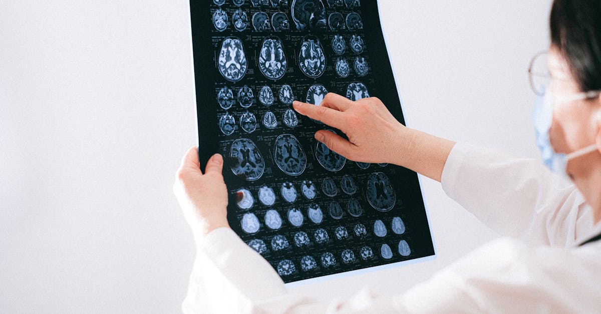 découvrez les fonctions distinctes des hémisphères cérébraux, leur rôle dans le fonctionnement du cerveau humain et comment ils influencent nos compétences et nos comportements quotidiens.