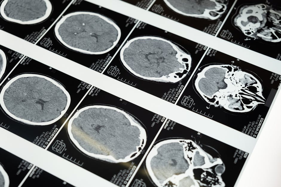 Brain scan or neuroscience concept