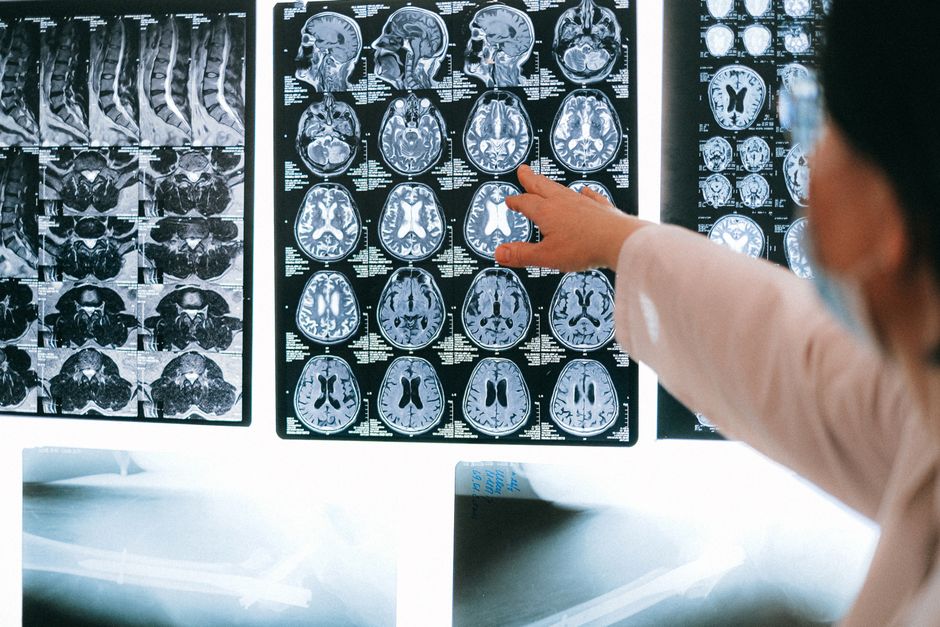 Brain scan or neuroscience concept illustrating love and attachment