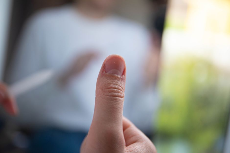 Ongles abîmés et cuticules irritées en gros plan